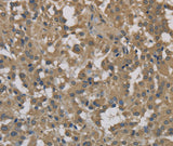 Anti-Human DCTN3 Antibody - ABMIUM