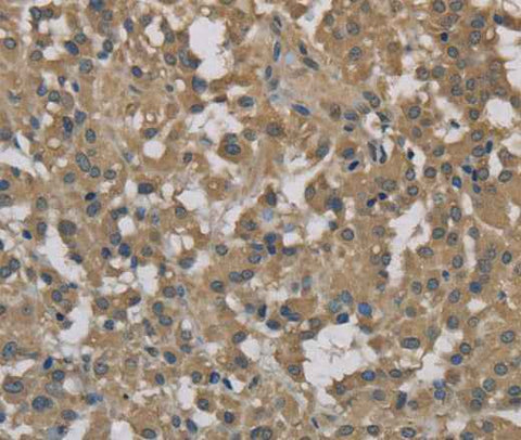 Anti-Human DCTN3 Antibody