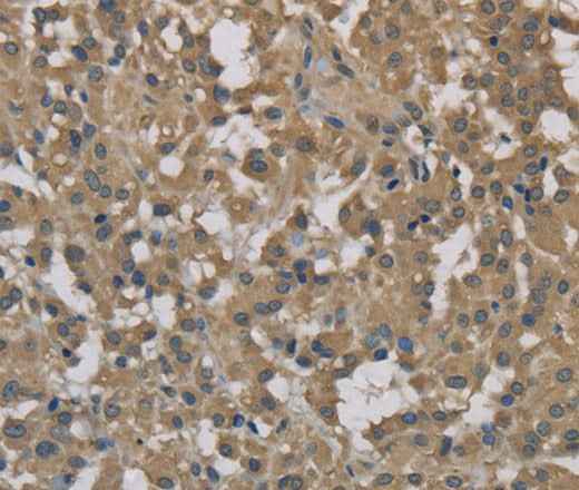 Anti-Human DCTN3 Antibody
