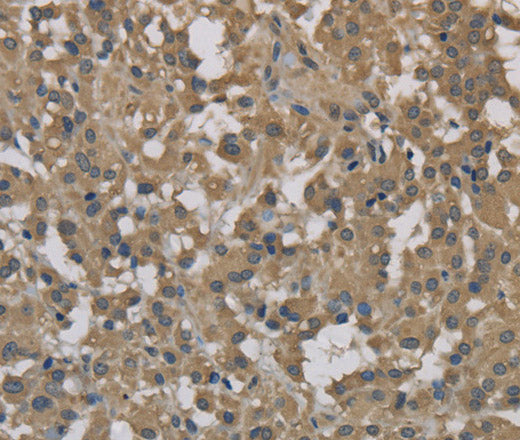 Anti-Human DCTN3 Antibody - ABMIUM