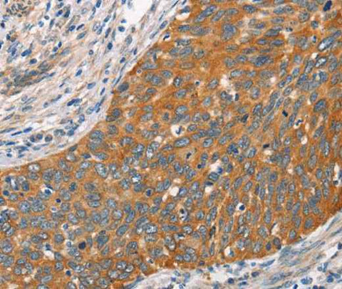 Anti-Human/Mouse/Rat Crystallin-alpha C Antibody