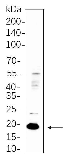 Anti-Human/Mouse/Rat Claudin 3 Antibody [B537] - ABMIUM