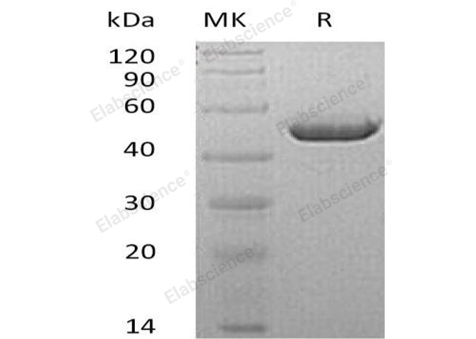 Recombinant Mouse Carbonic Anhydrase 4/CA4 Protein (aa 17-420, His Tag) - ABMIUM