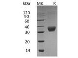 Recombinant Human Fas/CD95/TNFRSF6 Protein (His Tag) - ABMIUM