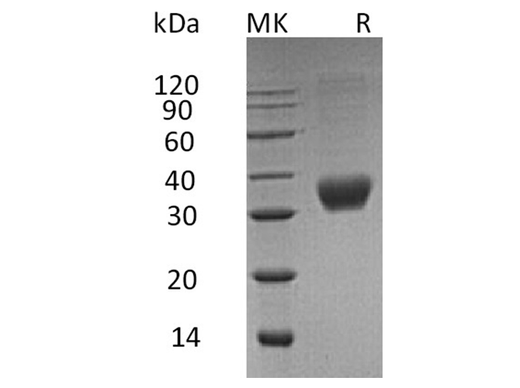 Recombinant Human Fas/CD95/TNFRSF6 Protein (His Tag) - ABMIUM