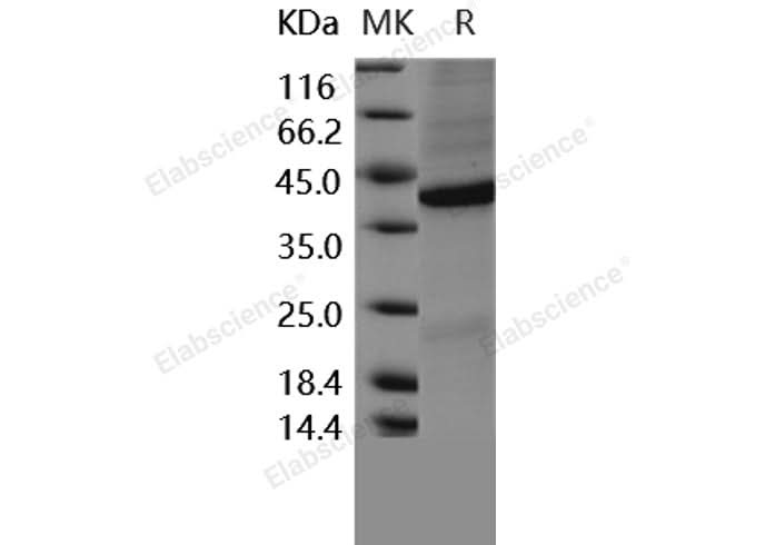 > 85 % as determined by reducing SDS-PAGE.