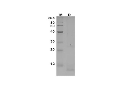 SDS-PAGE analysis of Human CXCL13/BCA-1 proteins, 2 μg/lane of Recombinant Human CXCL13/BCA-1 proteins was resolved with SDS-PAGE under reducing conditions, showing bands at 10 kDa.