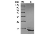 Recombinant Human Interleukin-15/IL-15 Protein - ABMIUM