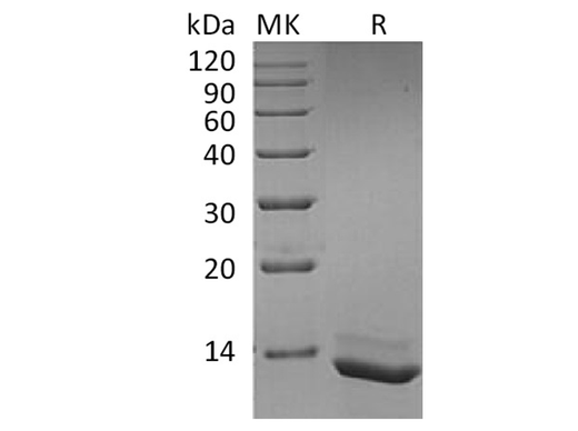 Recombinant Human Interleukin-15/IL-15 Protein - ABMIUM