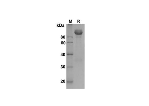SDS-PAGE analysis of Mouse VCAM-1/CD106 proteins , 2 μg/lane of Recombinant Mouse VCAM-1/CD106 proteins was resolved with SDS-PAGE under reducing conditions , showing bands at 102 kDa.
