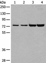 Western blot analysis of 293T and Hela cell lysates using MTA2 Polyclonal Antibody at dilution of 1:400