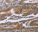 Anti-Human/Mouse/Rat FAF1 Antibody - ABMIUM