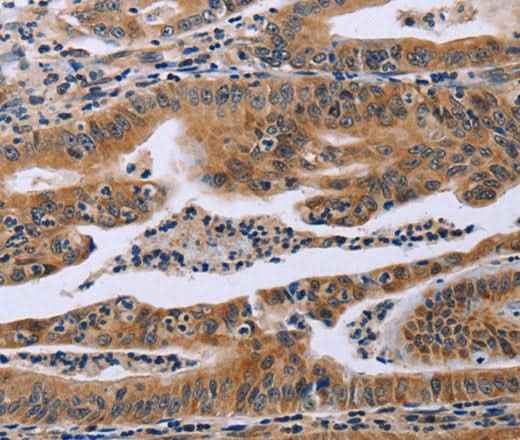 Anti-Human/Mouse/Rat FAF1 Antibody