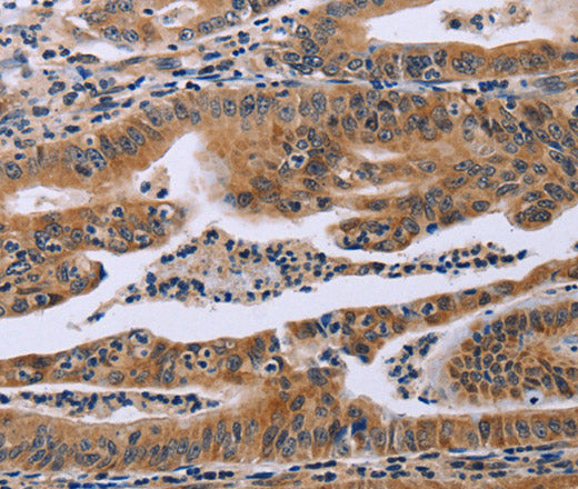 Anti-Human/Mouse/Rat FAF1 Antibody - ABMIUM