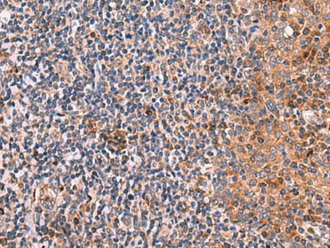 Immunohistochemistry of paraffin-embedded Human tonsil tissue using KLK9 Polyclonal Antibody at dilution of 1:50(×200)