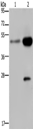 Anti-Human CD160 Antibody - ABMIUM