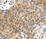 Anti-Human PLIN3 Antibody - ABMIUM