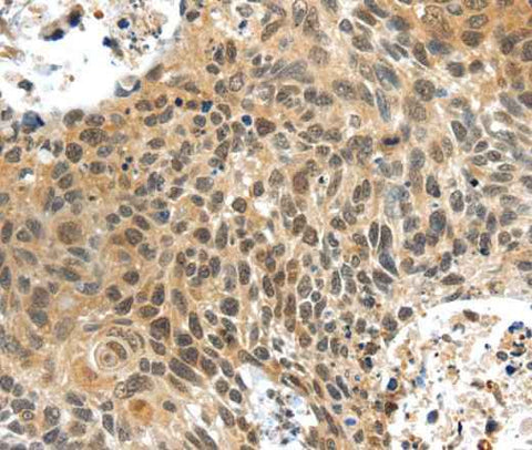 Anti-Human PLIN3 Antibody