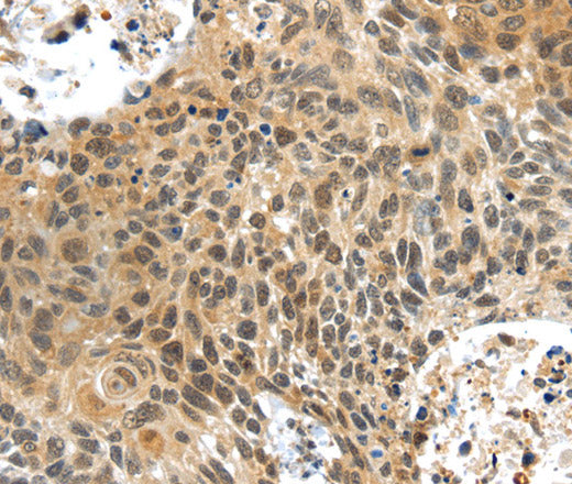 Anti-Human PLIN3 Antibody - ABMIUM