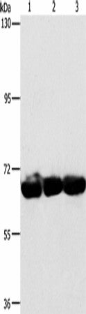 Anti-Human/Mouse CKAP4 Antibody - ABMIUM