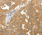 Anti-Human/Mouse/Rat MAP1B Antibody - ABMIUM