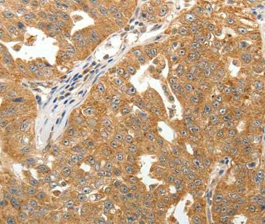Anti-Human/Mouse/Rat MAP1B Antibody