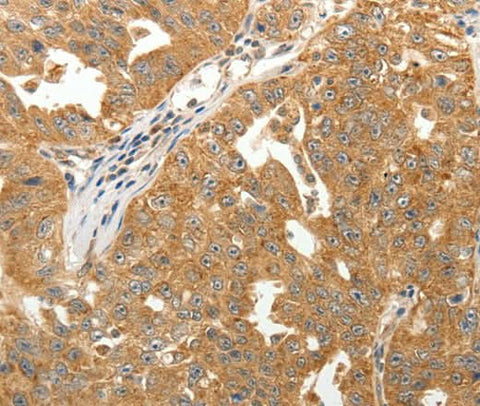 Anti-Human/Mouse/Rat MAP1B Antibody - ABMIUM
