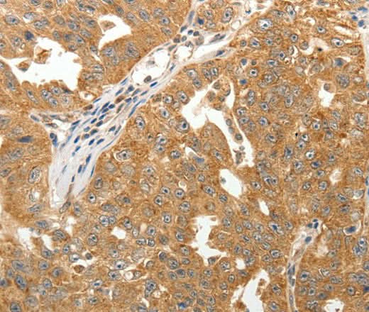 Anti-Human/Mouse/Rat MAP1B Antibody - ABMIUM
