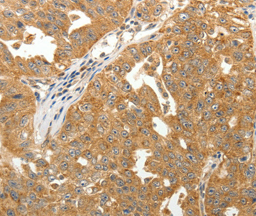 Anti-Human/Mouse/Rat MAP1B Antibody - ABMIUM