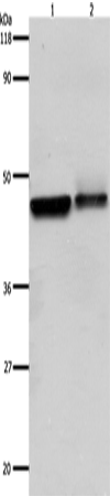 Anti-Human/Mouse ADRB2 Antibody - ABMIUM