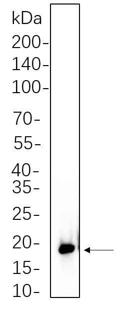 Anti-Human/Mouse/Rat 4E-BP1 Antibody [B1070] - ABMIUM