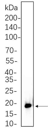 Anti-Human/Mouse/Rat 4E-BP1 Antibody [B1070]