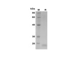 SDS-PAGE analysis of Human Frataxin/FXN proteins, 2 μg/lane of Recombinant Human Frataxin/FXN proteins was resolved with SDS-PAGE under reducing conditions, showing bands at 18 kDa.