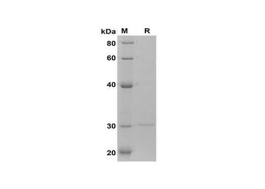 SDS-PAGE analysis of Human Arresten/COL4α1 proteins, 2 μg/lane of Recombinant Human Arresten/COL4α1 proteins was resolved with SDS-PAGE under reducing conditions, showing bands at 30 kDa.