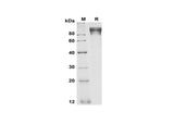 SDS-PAGE analysis of Human G-CSF R/CD114 proteins, 2 μg/lane of Recombinant Human G-CSF R/CD114 proteins was resolved with SDS-PAGE under reducing conditions, showing bands at 90-100 kDa.