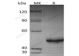 Recombinant Human EIF5A2 Protein (His Tag) - ABMIUM