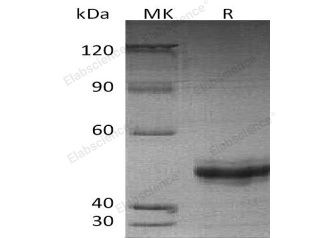 Recombinant Human EIF5A2 Protein (His Tag) - ABMIUM