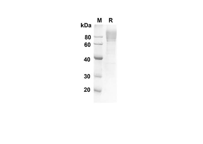 SDS-PAGE analysis of Human ADGRE5 proteins, 2 μg/lane of Recombinant Human ADGRE5 proteins was resolved with an SDS-PAGE under reducing conditions, showing bands at 55.9 kDa.