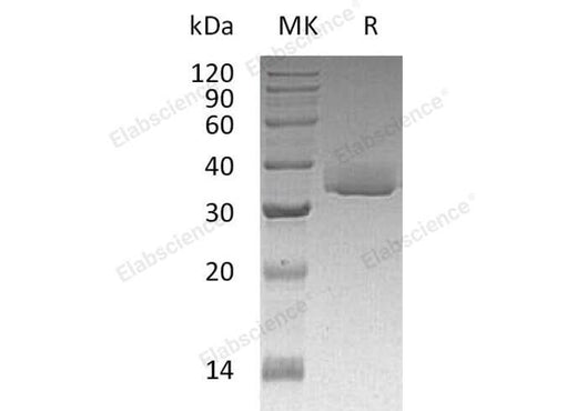 Recombinant Human Galectin-3/LGALS3 Protein (His Tag) - ABMIUM