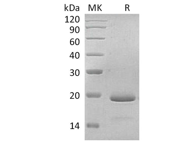 Recombinant Human Interleukin-11/IL-11 Protein - ABMIUM