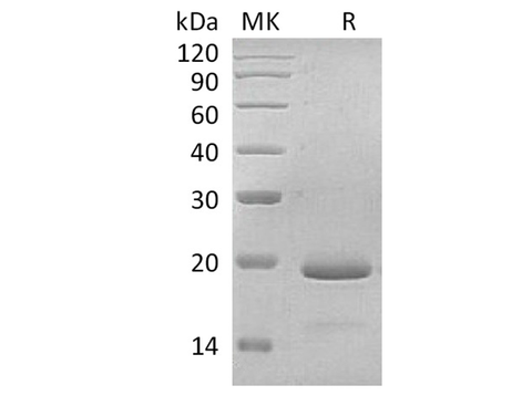 Recombinant Human Interleukin-11/IL-11 Protein - ABMIUM