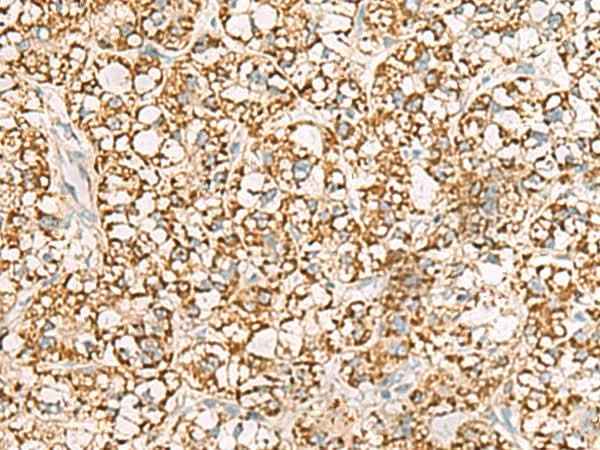 Anti-Human/Mouse ISOC2 Antibody