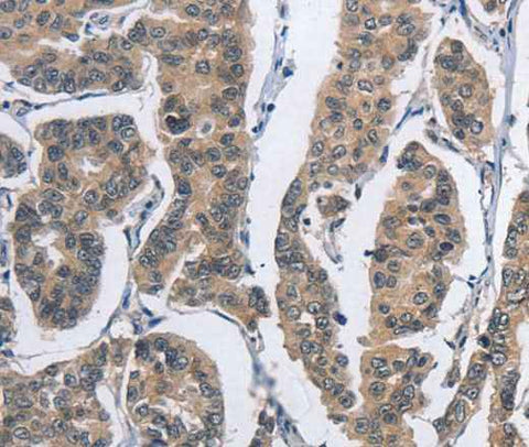 Anti-Human DSG2 Antibody