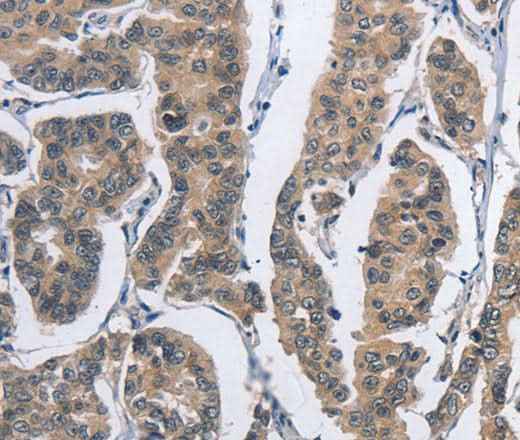 Anti-Human DSG2 Antibody