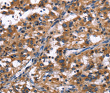 Anti-Human/Mouse R3HCC1L Antibody - ABMIUM