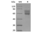 Recombinant Human Mucin-1/MUC-1 (C-Fc-Avi) Biotinylated - ABMIUM