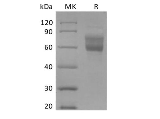 Recombinant Human Mucin-1/MUC-1 (C-Fc-Avi) Biotinylated - ABMIUM