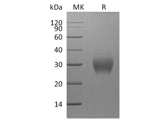 Recombinant Human Fibrillin-1/FBN1 Protein (His Tag) - ABMIUM