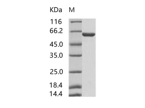 Recombinant HIV-p51 / RT-p51 (group M, subtype B (isolate HXB2) Gag-Pol polyprotein Protein (His Tag) - ABMIUM