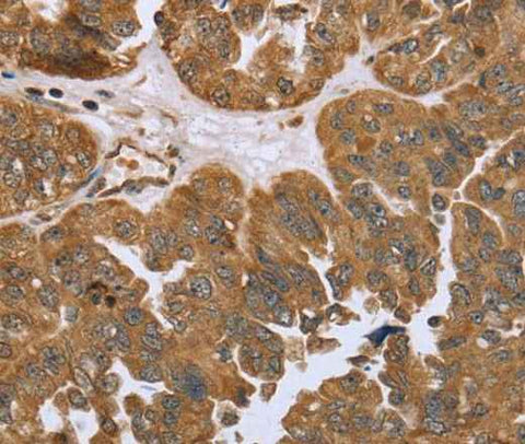 Anti-Human/Mouse IKBKE Antibody - ABMIUM